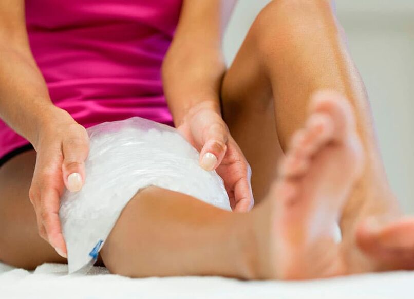 Con venas varicosas en las piernas, se recomienda hacer compresas para eliminar el dolor.